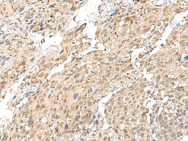 Rabbit Polyclonal Antibody to HNRNPUL1