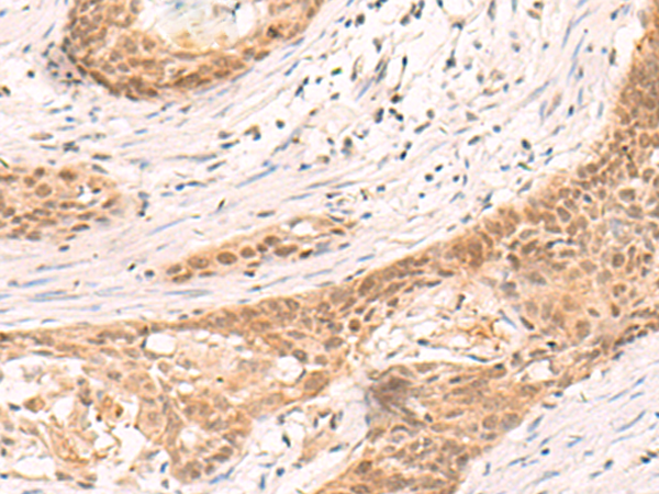 Rabbit Polyclonal Antibody to SIX6