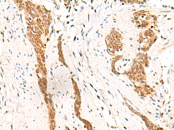 Rabbit Polyclonal Antibody to HOXC13