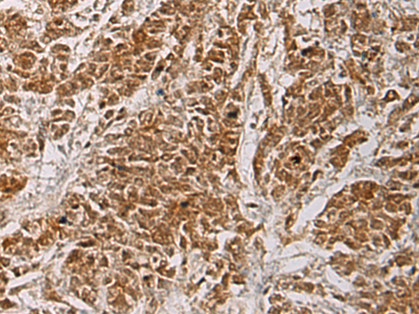 Rabbit Polyclonal Antibody to HOXC5