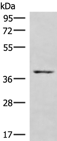 Rabbit Polyclonal Antibody to HOXD9