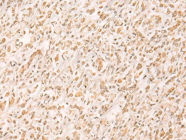 Rabbit Polyclonal Antibody to SETD1A