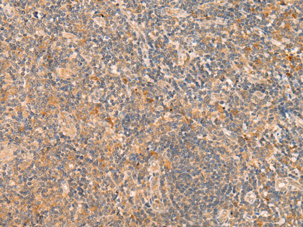 Rabbit Polyclonal Antibody to HSH2D