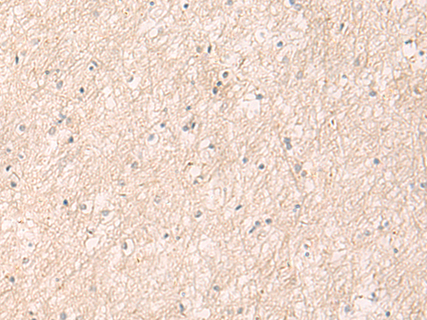 Rabbit Polyclonal Antibody to HSPA4L