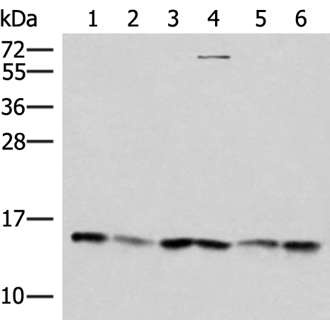 Rabbit Polyclonal Antibody to TRMT112