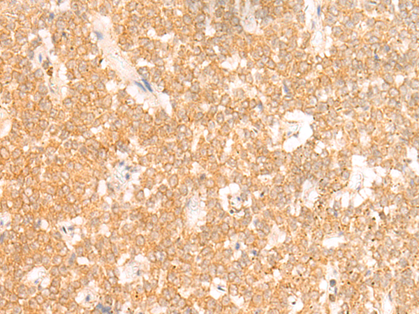 Rabbit Polyclonal Antibody to RRP8