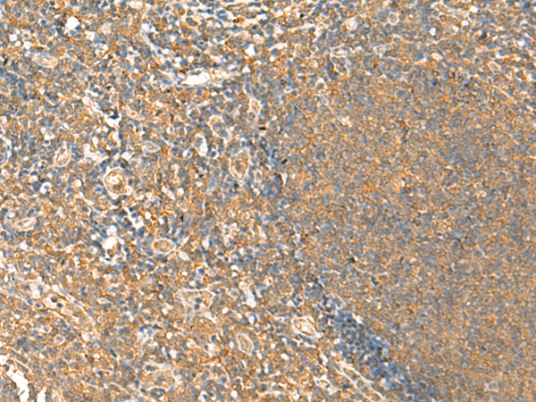 Rabbit Polyclonal Antibody to HTT