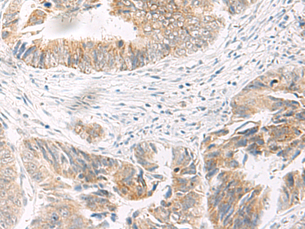Rabbit Polyclonal Antibody to IDUA