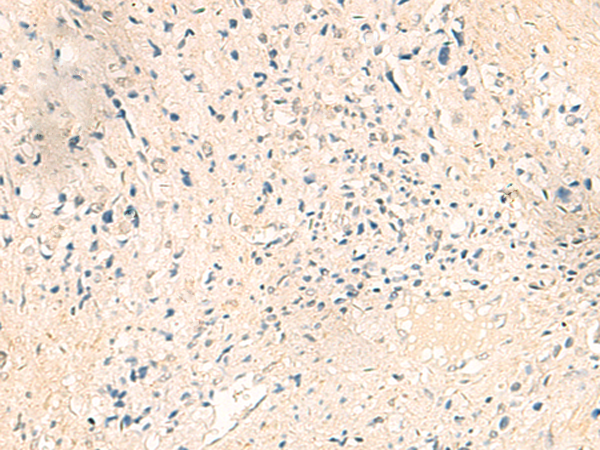 Rabbit Polyclonal Antibody to IER5