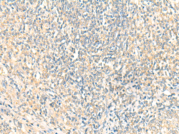 Rabbit Polyclonal Antibody to MTIF2