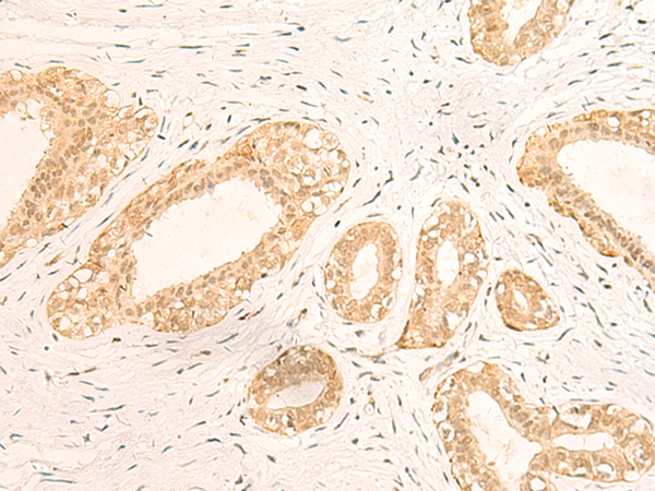 Rabbit Polyclonal Antibody to IFI35