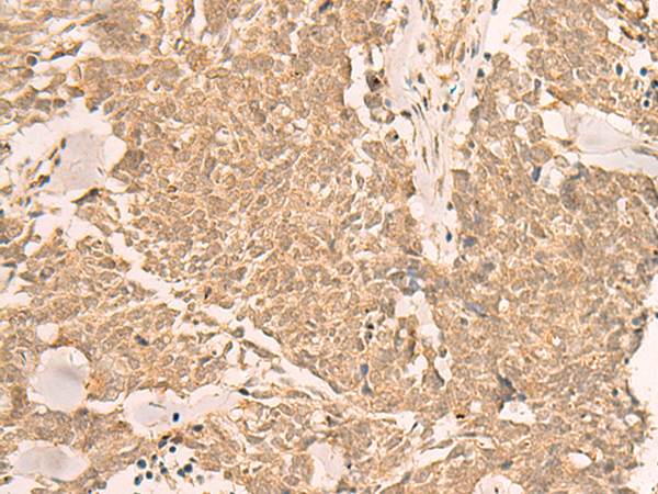 Rabbit Polyclonal Antibody to IL1RAPL2