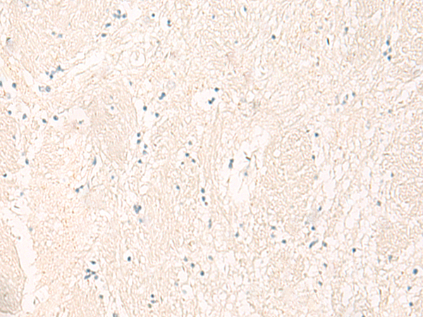 Rabbit Polyclonal Antibody to IL12B