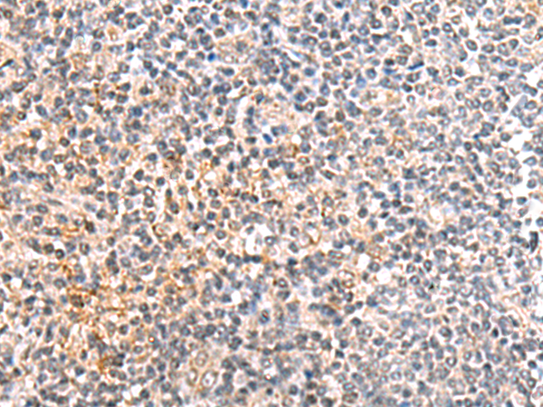 Rabbit Polyclonal Antibody to IL36B