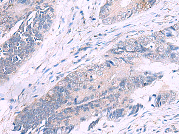 Rabbit Polyclonal Antibody to IL4R