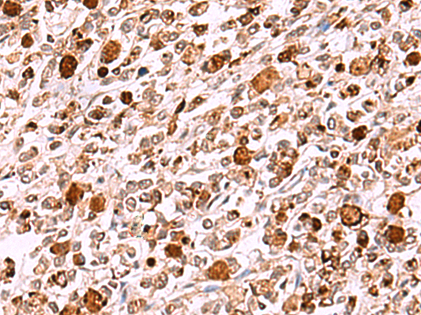 Rabbit Polyclonal Antibody to INO80