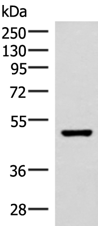 Rabbit Polyclonal Antibody to IP6K2