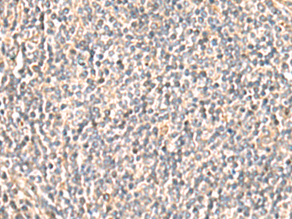 Rabbit Polyclonal Antibody to OCRL