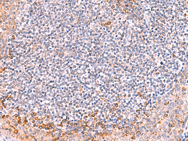 Rabbit Polyclonal Antibody to ITSN2