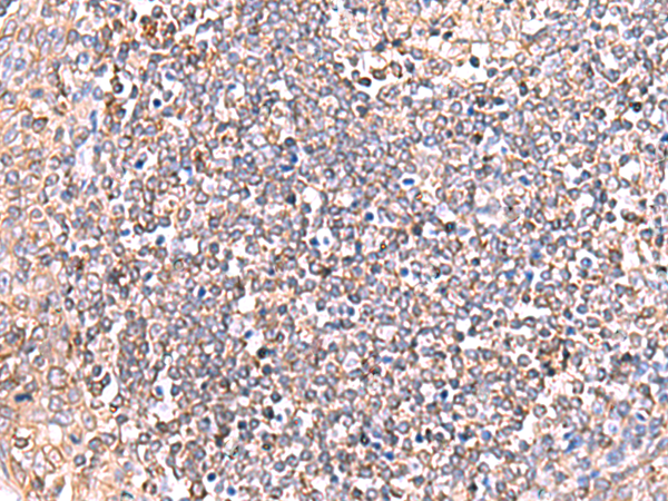 Rabbit Polyclonal Antibody to GRIA2