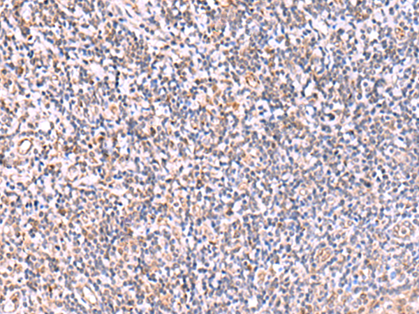 Rabbit Polyclonal Antibody to ITPKC