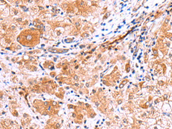 Rabbit Polyclonal Antibody to IRGC