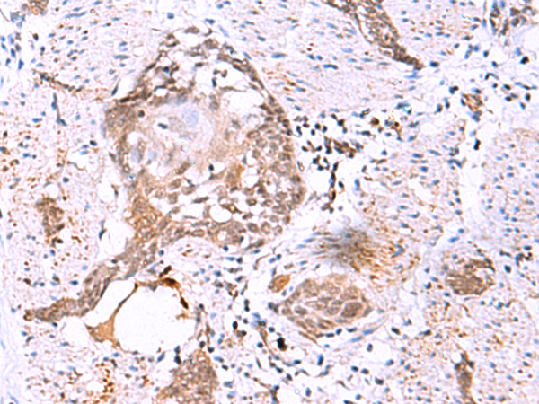 Rabbit Polyclonal Antibody to IRX3