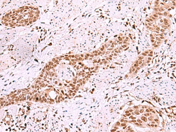 Rabbit Polyclonal Antibody to ISL2