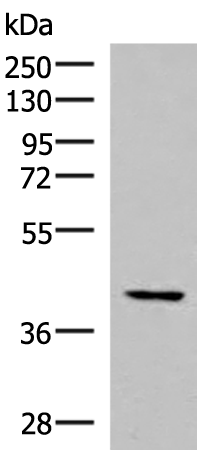 Rabbit Polyclonal Antibody to IST1