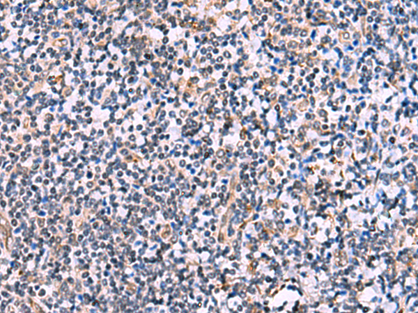 Rabbit Polyclonal Antibody to NMRK2