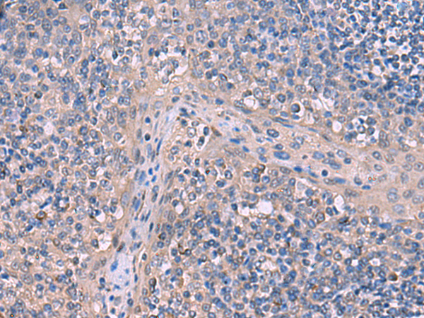 Rabbit Polyclonal Antibody to ITPR2