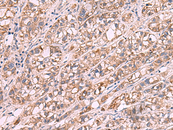 Rabbit Polyclonal Antibody to JAZF1