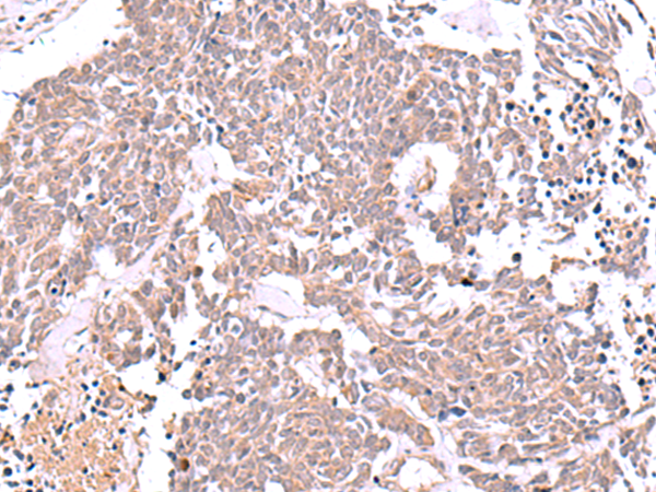 Rabbit Polyclonal Antibody to JDP2