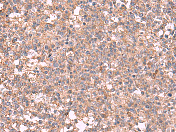 Rabbit Polyclonal Antibody to MAPK8IP3