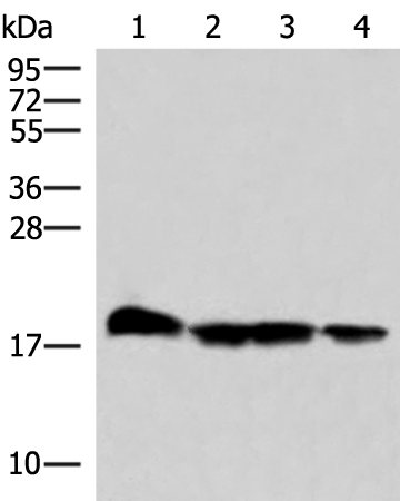 Rabbit Polyclonal Antibody to PEMT