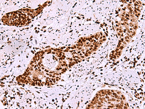 Rabbit Polyclonal Antibody to TMEM18