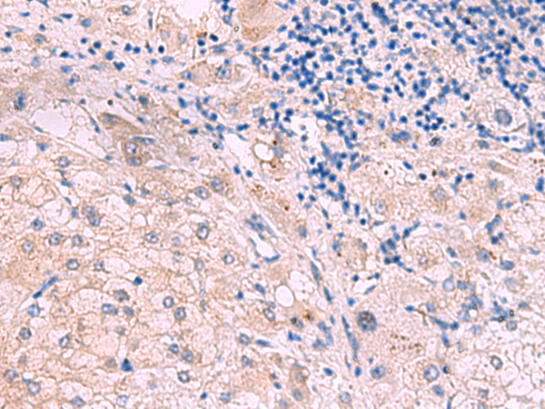 Rabbit Polyclonal Antibody to JPH2