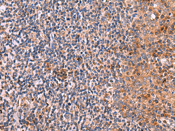 Rabbit Polyclonal Antibody to KLK9