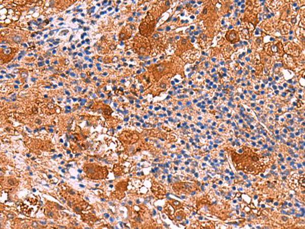 Rabbit Polyclonal Antibody to KANK3