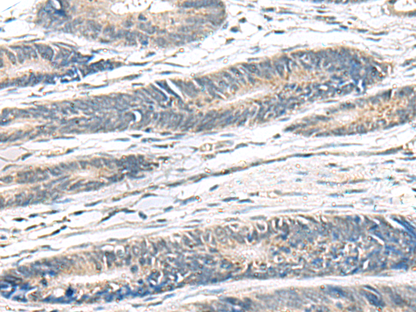 Rabbit Polyclonal Antibody to TNF