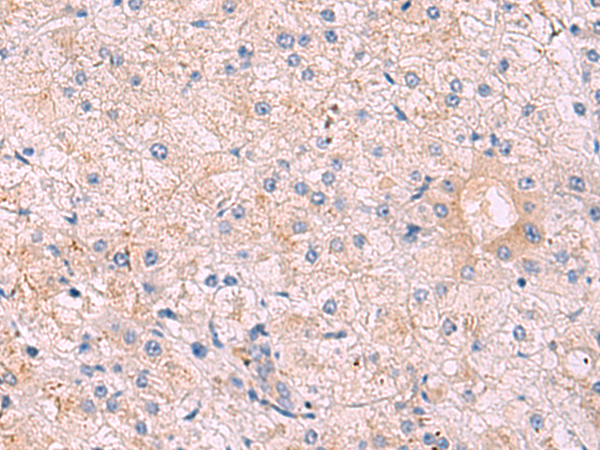 Rabbit Polyclonal Antibody to KANSL1L