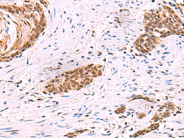 Rabbit Polyclonal Antibody to CREBBP