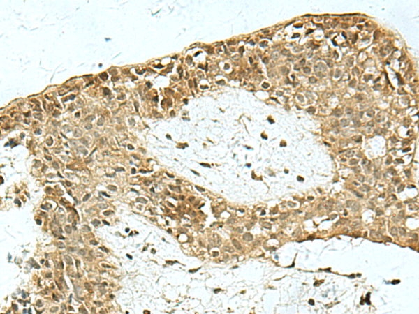 Rabbit Polyclonal Antibody to KAT7