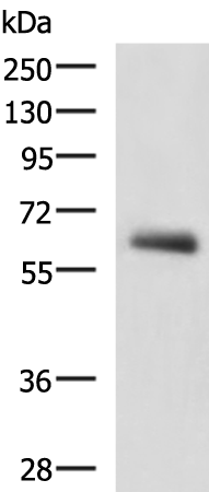 Rabbit Polyclonal Antibody to KBTBD11