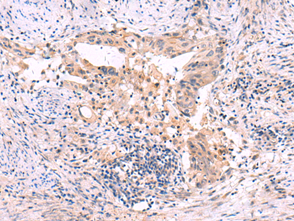 Rabbit Polyclonal Antibody to SLC12A5