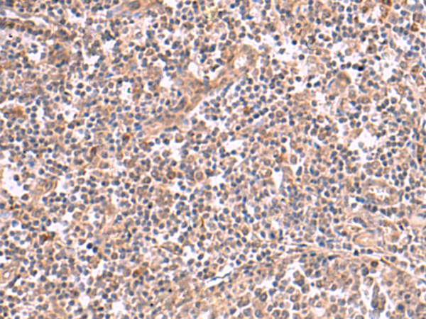 Rabbit Polyclonal Antibody to SLC12A7