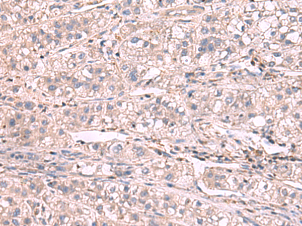 Rabbit Polyclonal Antibody to KCNIP1