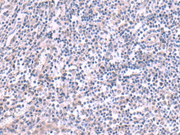 Rabbit Polyclonal Antibody to KCNK10