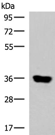 Rabbit Polyclonal Antibody to KCNK15