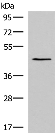Rabbit Polyclonal Antibody to KCNK18